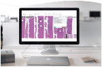 Automated AI in Digital Pathology | Lumea Pathologist save time with auto ai integrated with lumea's digital pathology platform