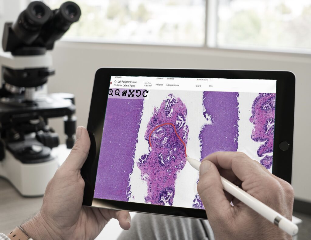 Pathology digital signout on tablet 3 | Lumea Pathologist diagnosing remotely