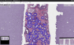 Digital pathology technology and ai