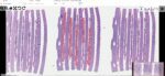Annotations in lumea's digital slide viewer