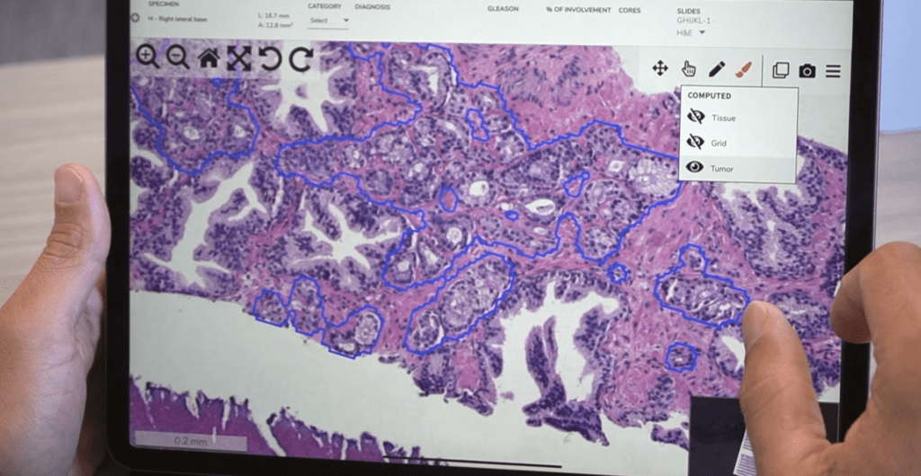 Artificial intelligence pathology