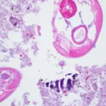 Pathology now