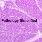 Pathology simplified youtube