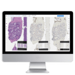 Lumea digital pathology benefits