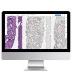 Dxalign lumea digital pathology tech