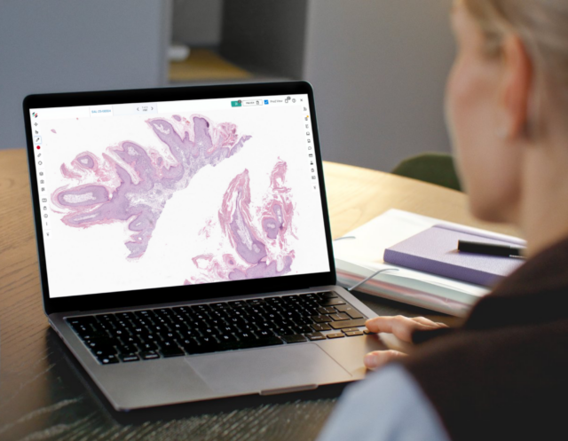A pathologist looking at digital dermatology slides on heir computer